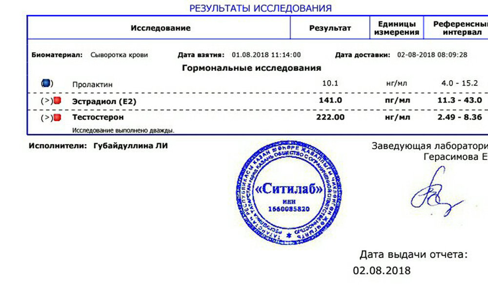 Анализ Susto 250 и Oxa 10 от Chang